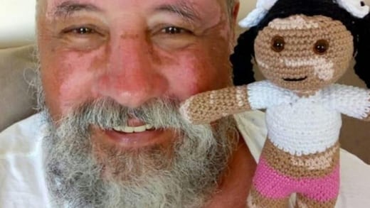 Abuelo crea muñecas con vitiligo para hacer feliz a su nieta