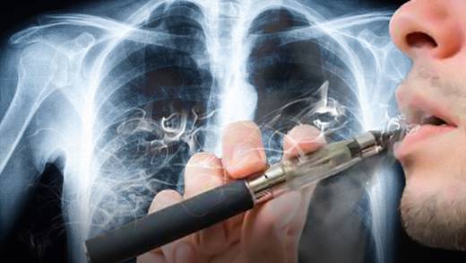 Esta es la peligrosa enfermedad asociada al uso de vapeadores o cigarros electrónicos