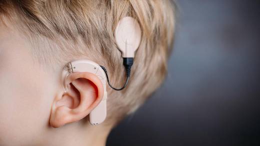 SCJN ordena a IMSS dar implante coclear a niño con discapacidad auditiva