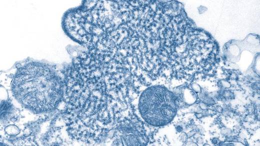 ¿Qué es el virus Nipah? India busca contener brote que ha cobrado al menos 2 vidas