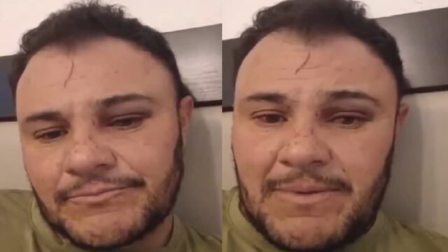 Israel, víctima de Lord Pádel Germán Mondragón, habla tras la golpiza que recibió