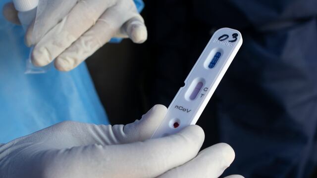 Prueba coronavirus