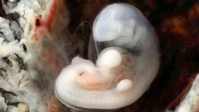 Científicos presentaron el  primer híbrido de embriones oveja-humanos.