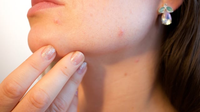 Aplicación de retinol