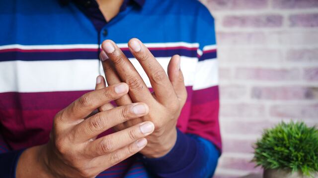 Esclerosis sistémica / Imagen ilustrativa