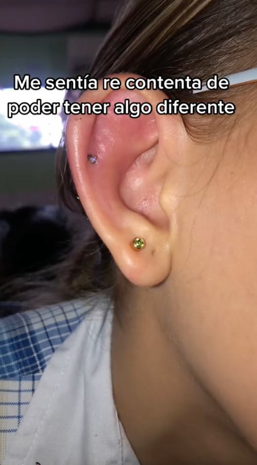 Usuaria de TikTok se hace un piercing que sale mal