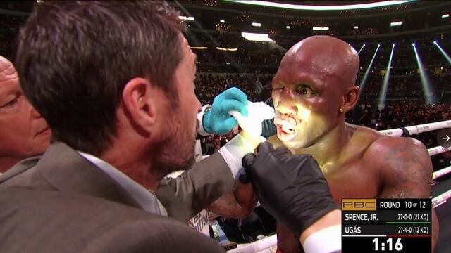 Ugás (Foto: Captura de video)