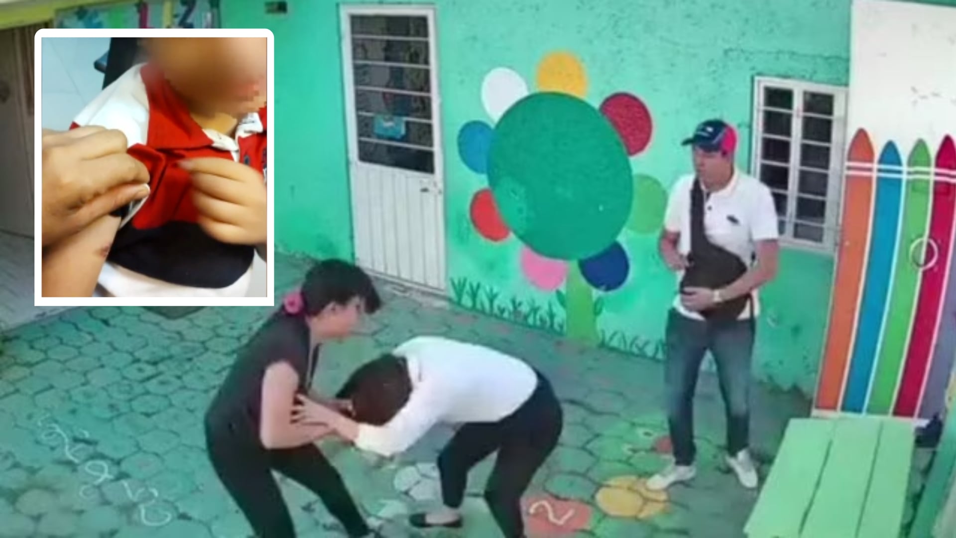Padres aseguran que agredieron a la maestra por herida en el brazo de su hijo