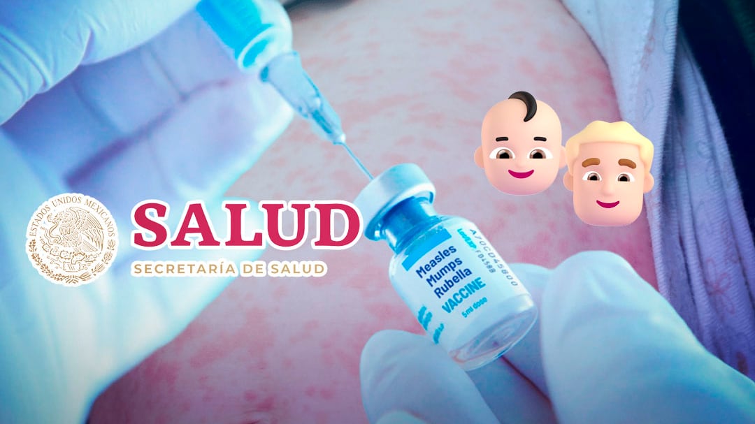 Salud pide vacunar contra sarampión a personas entre 6 meses y 49 años