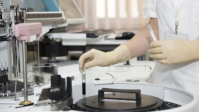 La proteína celular Transportina 3 actúa a varios niveles en el ciclo del VIH.