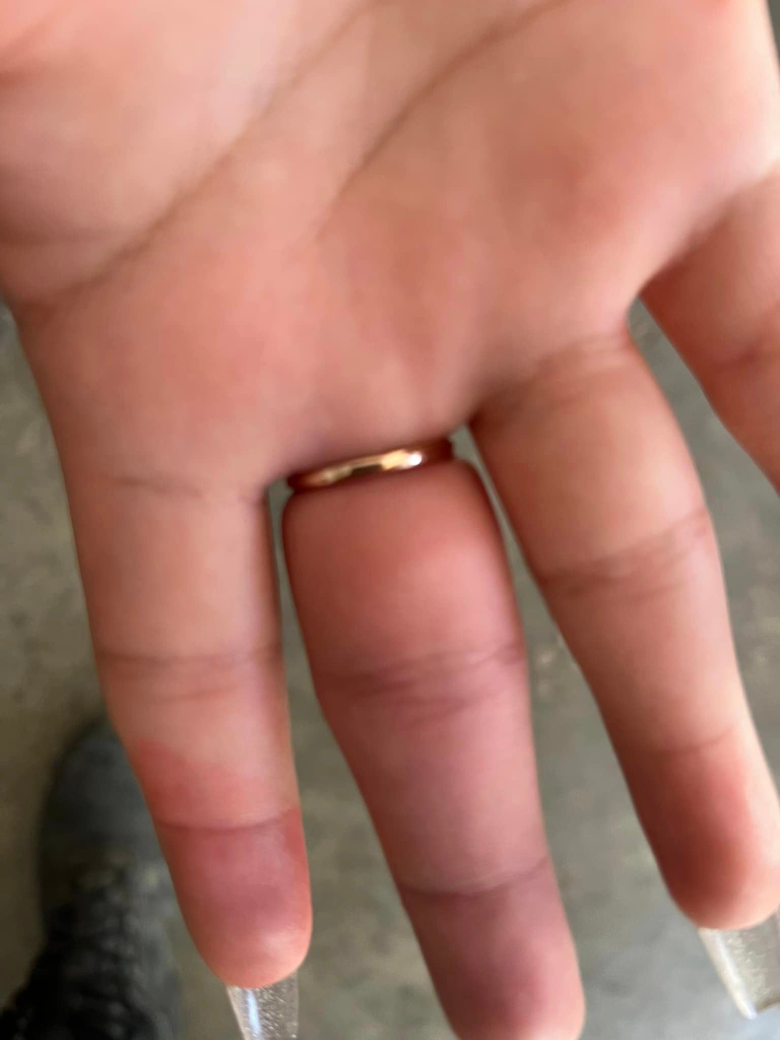 Mujer se atora el dedo en un anillo y tuvo que llamar hasta a los bomberos
