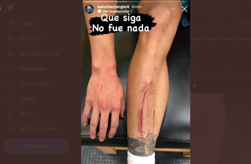 Jorge Sánchez mostró su herida tras el Clásico Nacional