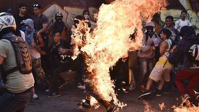 Rociaron gasolina a joven y le prendieron fuego.