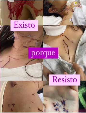 Mya Saldaña víctima de intento de feminicidio