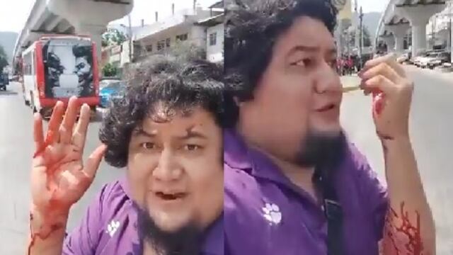 José González, periodista de Guerrero, hace transmisión en vivo tras ser baleado y exige justicia