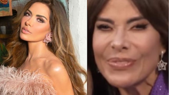 Gloria Trevi aparece con el rostro deformado, experta explica porqué