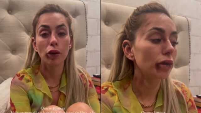 Florencia Alduncin, conductora de Televisa, es golpeada por policías de Querétaro y teme por su vida