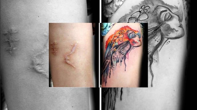 A Pele da Flor: tatuajes en cicatrices de quienes han sufrido violencia de género