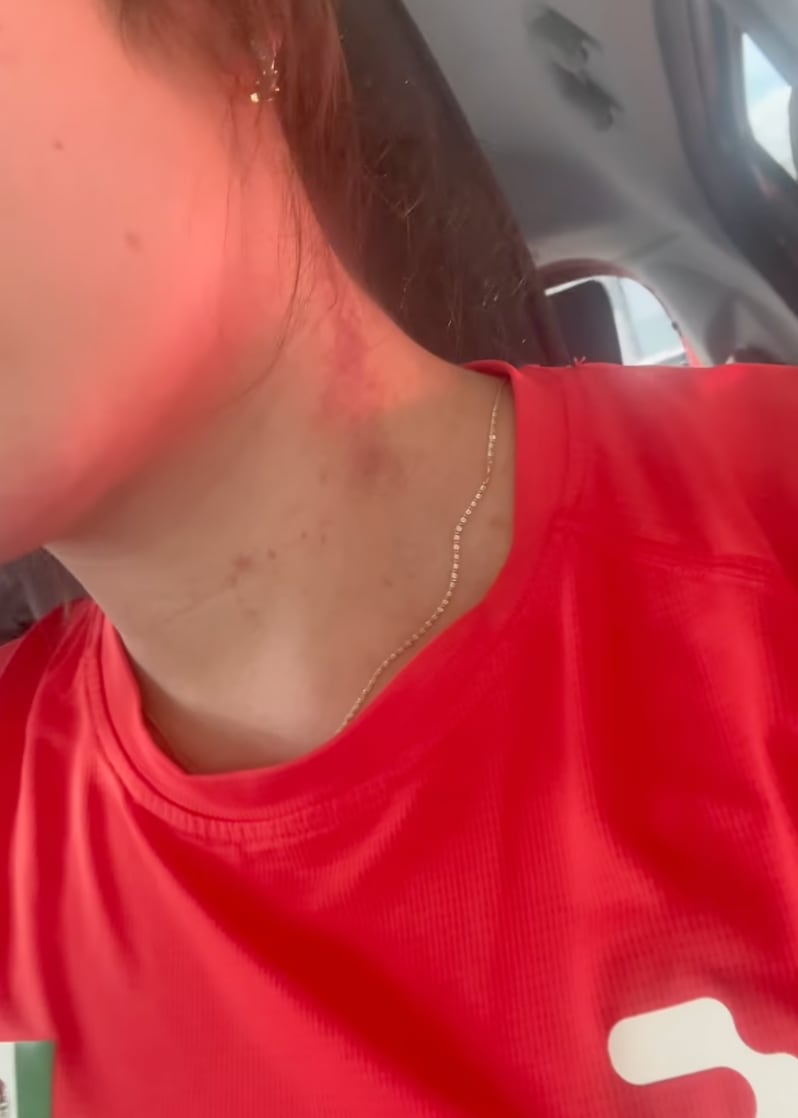 Catherine Mayran Oliver, pentatleta, fue agredida en Bosque del Ocotal