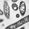 Crecen los casos por brote de bacteria en Nueva York