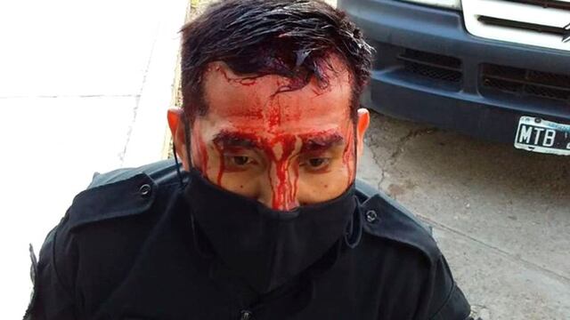 Policía agredido.