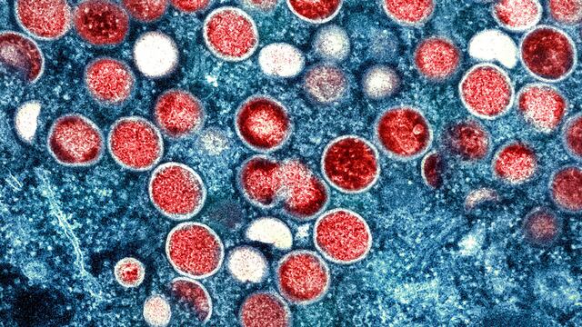 OMS rebautiza a la viruela del mono como “mpox”