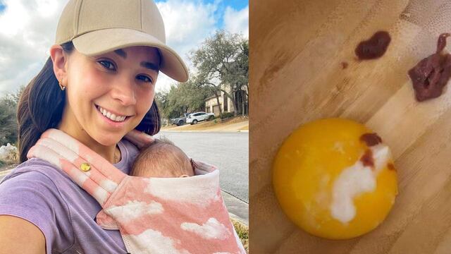 Rawvana da huevo e hígado crudo de comer a su bebé