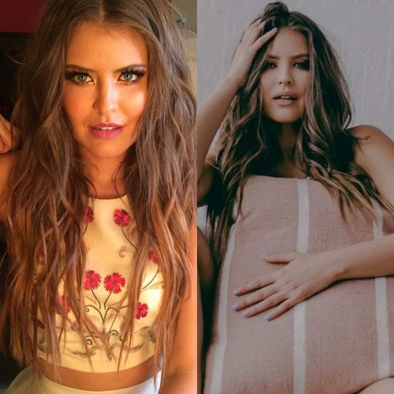 Vanessa Claudio (antes y después).