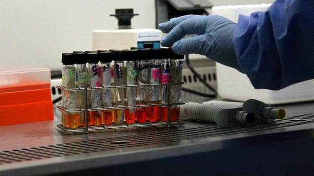 En abril del 2009 se registraron los primeros casos de la influenza H1N1