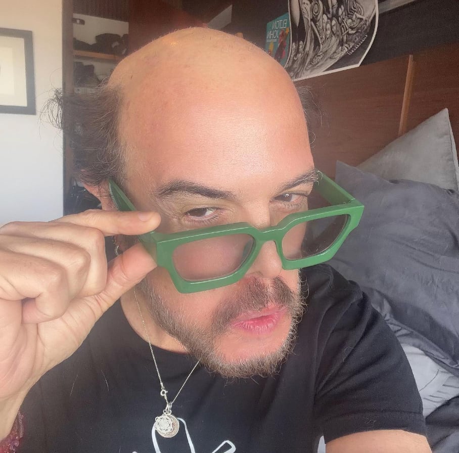Sorprende imagen de Aleks Syntek calvo