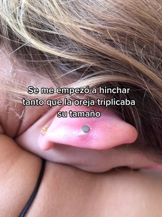 Va a dar al hospital por un piercing que salió mal