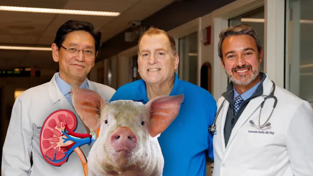 El hombre que vivió 271 días con un riñón de cerdo y marcó un récord