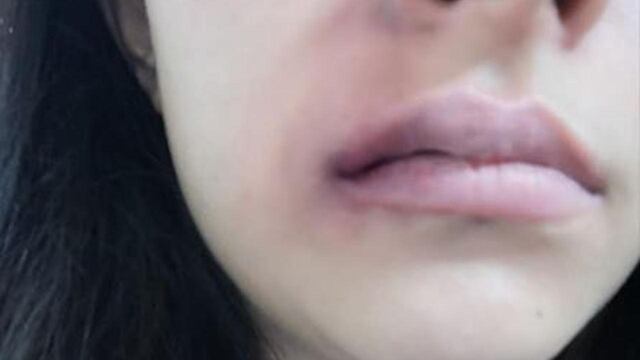 Golpe en el rostro de Jovana