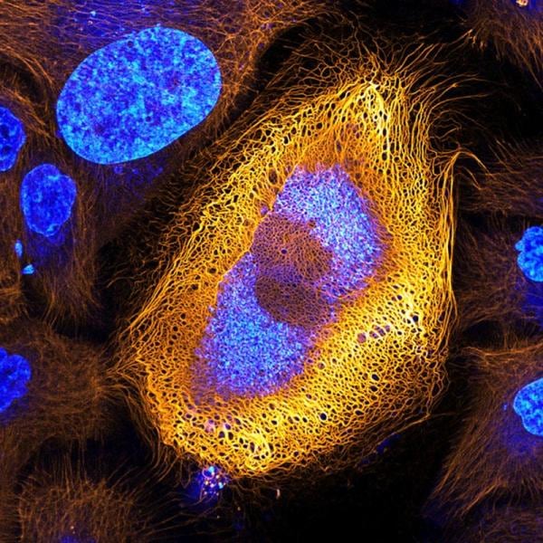 Queratinocito, el tipo de célula epitelial más común en la piel humana.