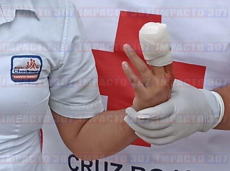 Empleada con dos dedos parcialmente amputados