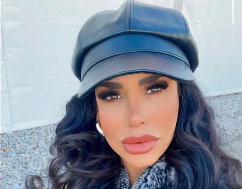 A Lis Vega no le molesta que sus operaciones se vean exageradas