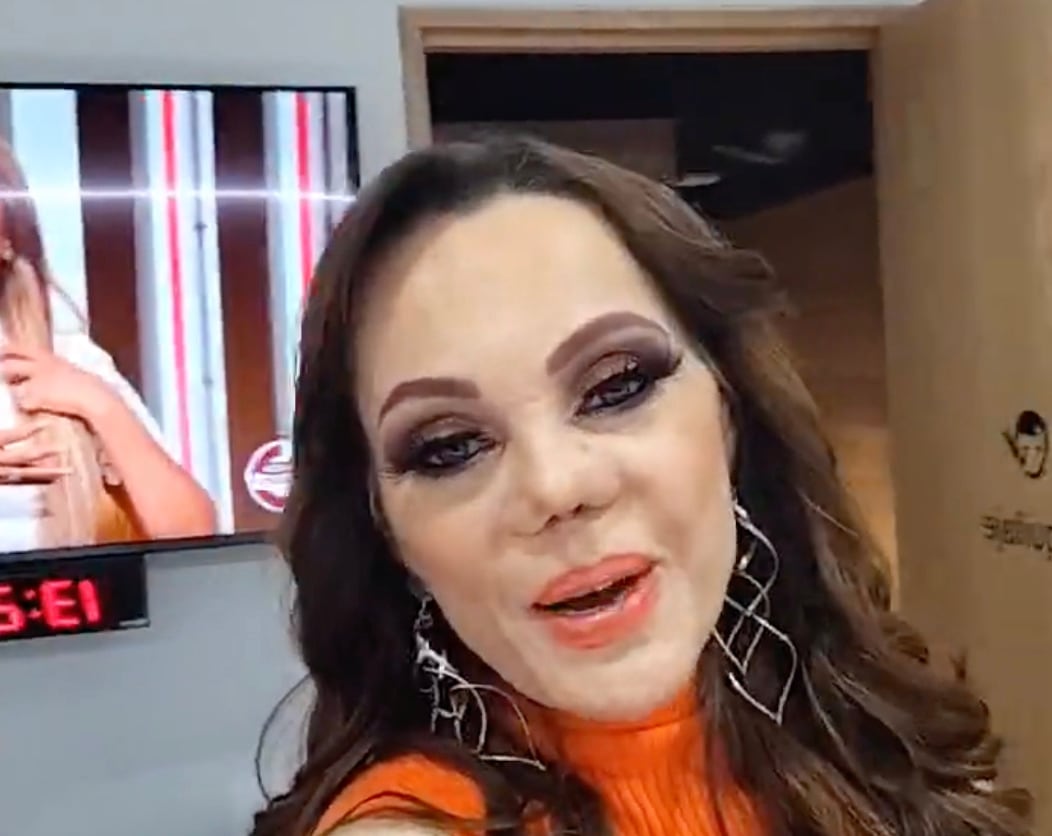 Carmen Campuzano presume su nueva nariz