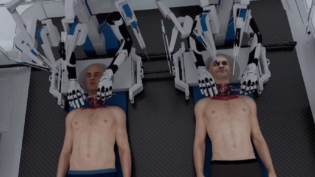 ¿Trasplante de cabeza es posible? La inteligencia artificial tal vez ha llegado muy lejos