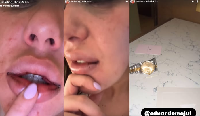 Isa Castro fue golpeada por su novio