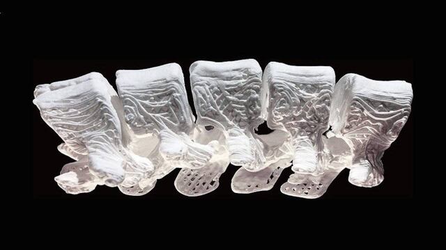 Un implante de hueso impreso en 3D.
