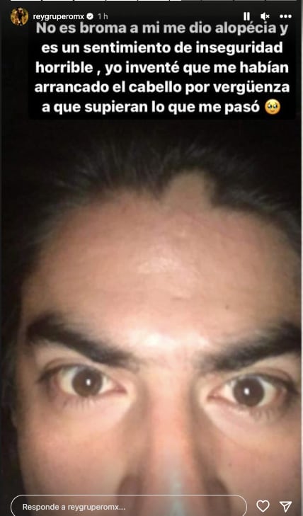 Rey Grupero se volvió inseguro por su alopecia