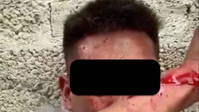 Sujeto golpeado en Iztapalapa