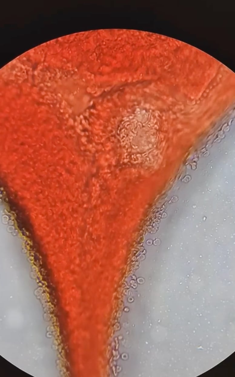 Coágulo de sangre menstrual bajo el microscopio