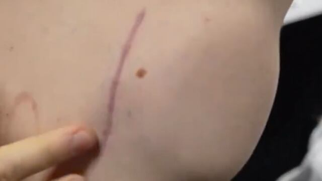 Desfibrilador automático de Tom Lockyer