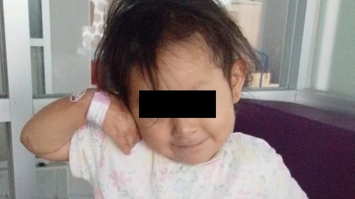 Jazlyn, víctima de la explosión en Iztapalapa, se recupera tras cirugía por secuelas de quemaduras