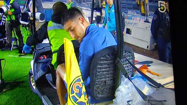 Sebastián Cáceres se lesionó en el América vs Puebla.