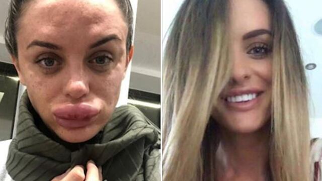 Rachel Knappier, Reino Unido.