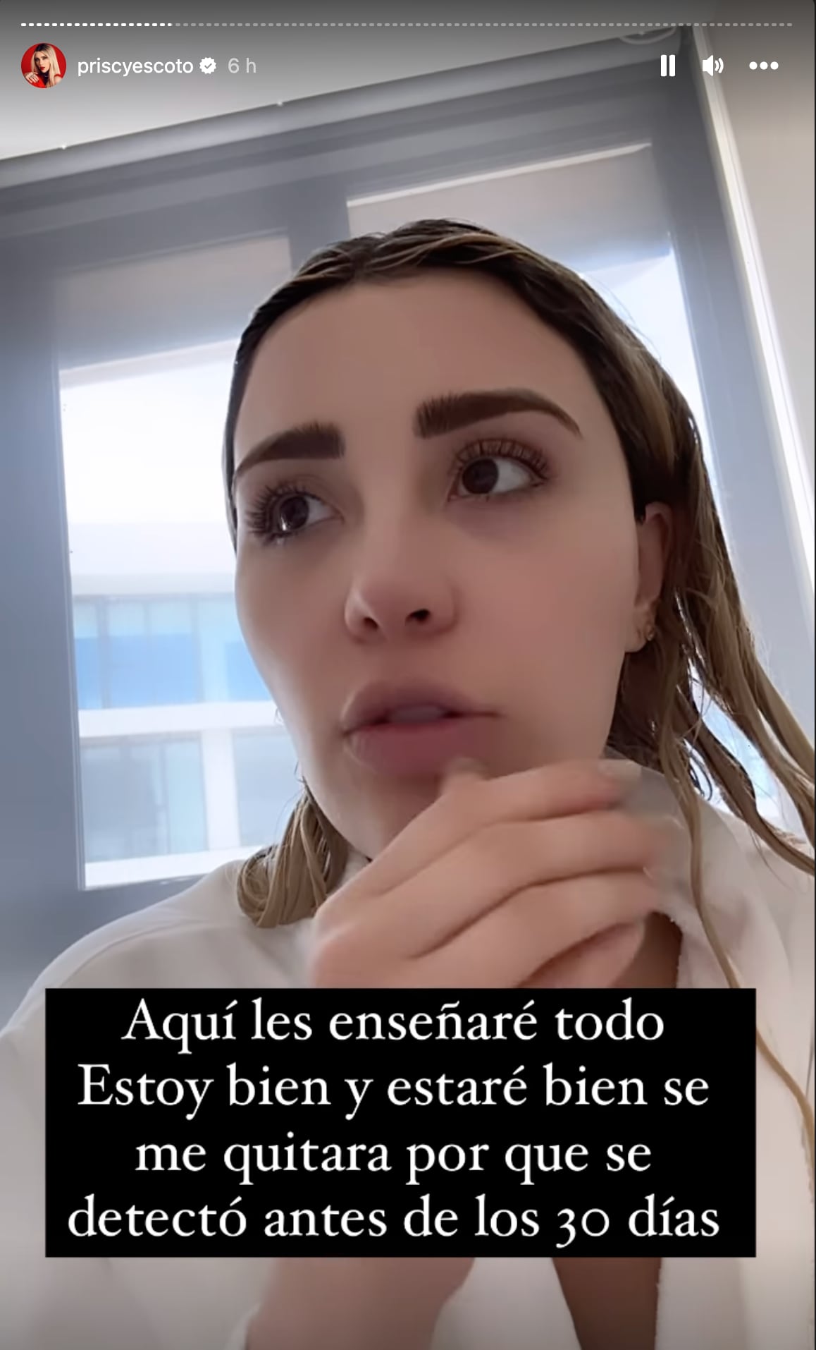 Priscila Escoto diagnosticada con la enfermedad de Lyme