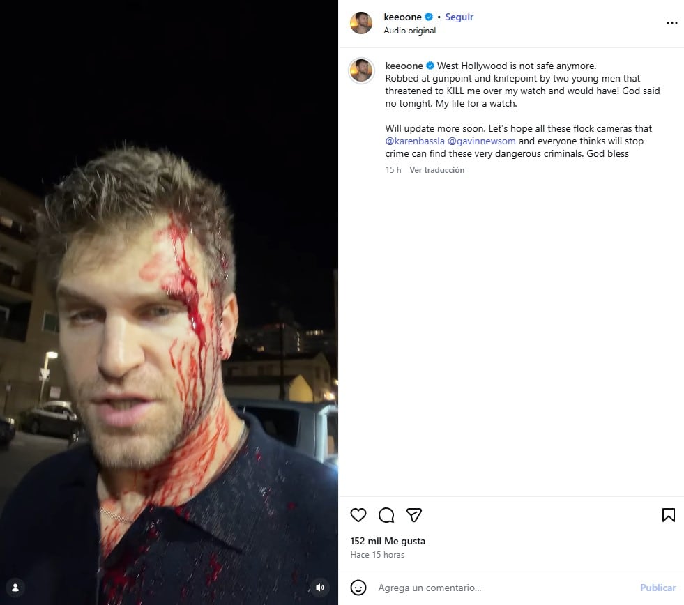 ¿Qué le pasó a Keegan Allen? Actor de Pretty Little Liars sufre asalto armado