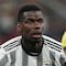 ¿Quién es Paul Pogba, el campeón del mundo que fue sancionado 4 años por dar positivo en prueba antidoping?